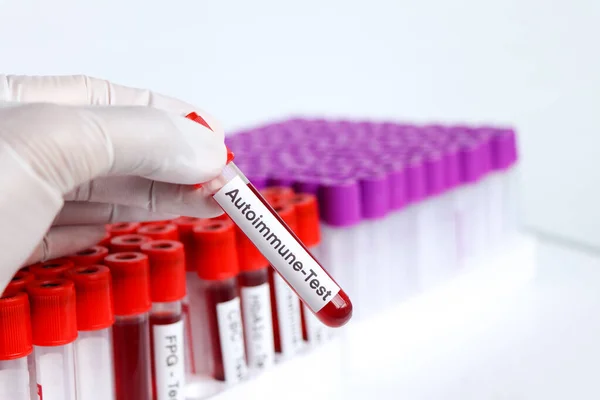 Mennyibe kerül egy autoimmun vizsgálat?