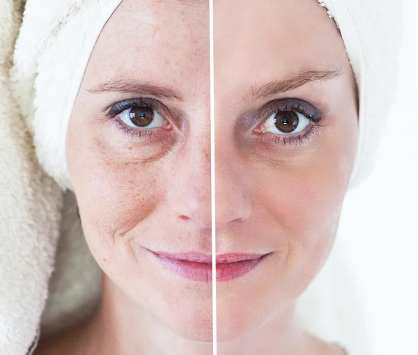 Mennyibe kerül egy anti-aging kezelés?